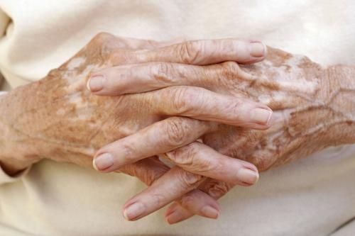 我们怎样才能有效识别白癜风?