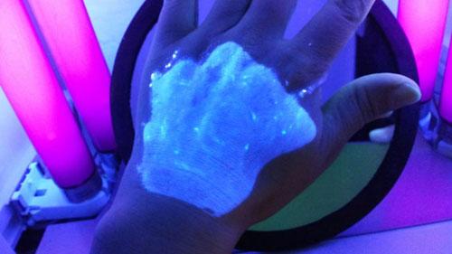 为什么会得白癜风